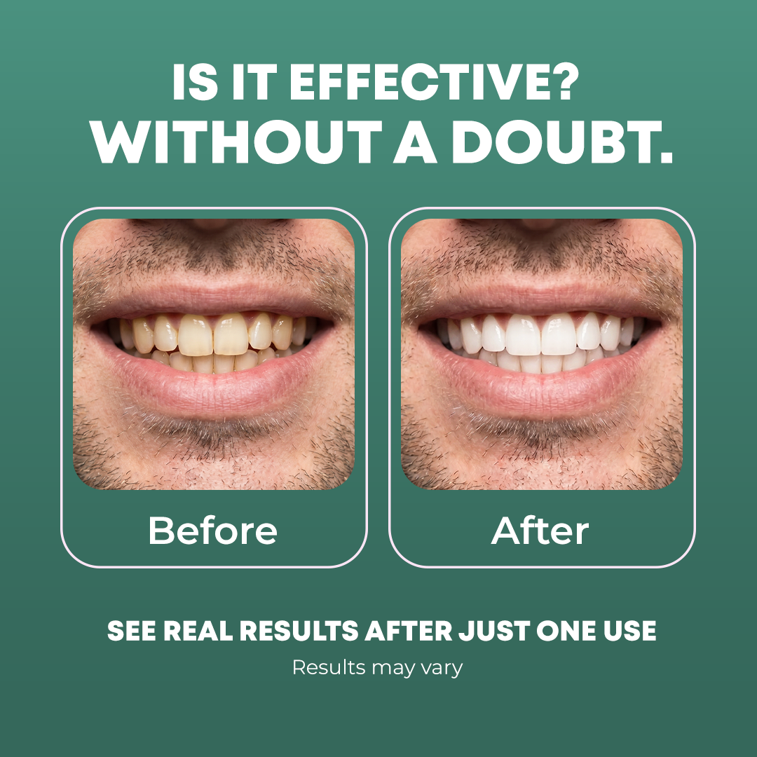 Peroxide-Free Whitening Strips