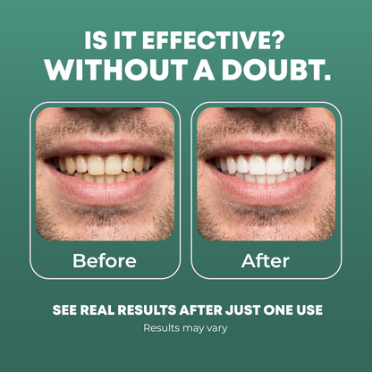 Peroxide-Free Whitening Strips